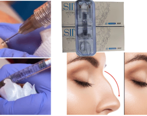تزریق اسید هیالورونیک در صورت، پرکننده پوست لب Ce MSDS ISO