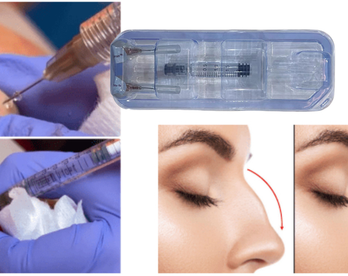 FDA مجوز تزریق ژل اسید هیالورونیک را برای مقعد صادر کرد