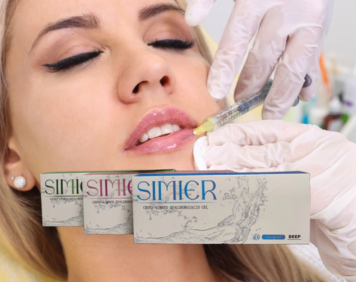 5ml 30mg/Ml Chin Hyaluronic Acid Cross Linked ضد چروک