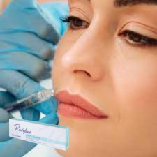 اسید هیالورونیک تزریقی پرکننده پوست ژل تزریقی برای لب