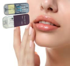 2 X 1 ml Juvederm Ultra 4 تزریق شده پرکننده پوست تزریق شده پرکننده لب