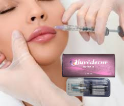 2 X 1 ml Juvederm Ultra 4 تزریق شده پرکننده پوست تزریق شده پرکننده لب