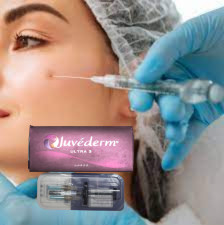 پیچ های بینی لب 2x1ml پرکننده پوست اسید هیالورونیک Juvederm Ultra3