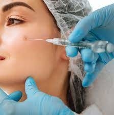 چین و چروک های صاف تزریقی پرکننده پوست اسید هیالورونیک Juvederm Ultra 3 2*1ml